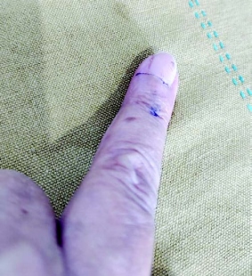 When indelible ink ‘vanished’ within hours of voting