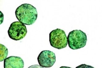 17th century coins unearthed from farm at Nanoda, Sattari