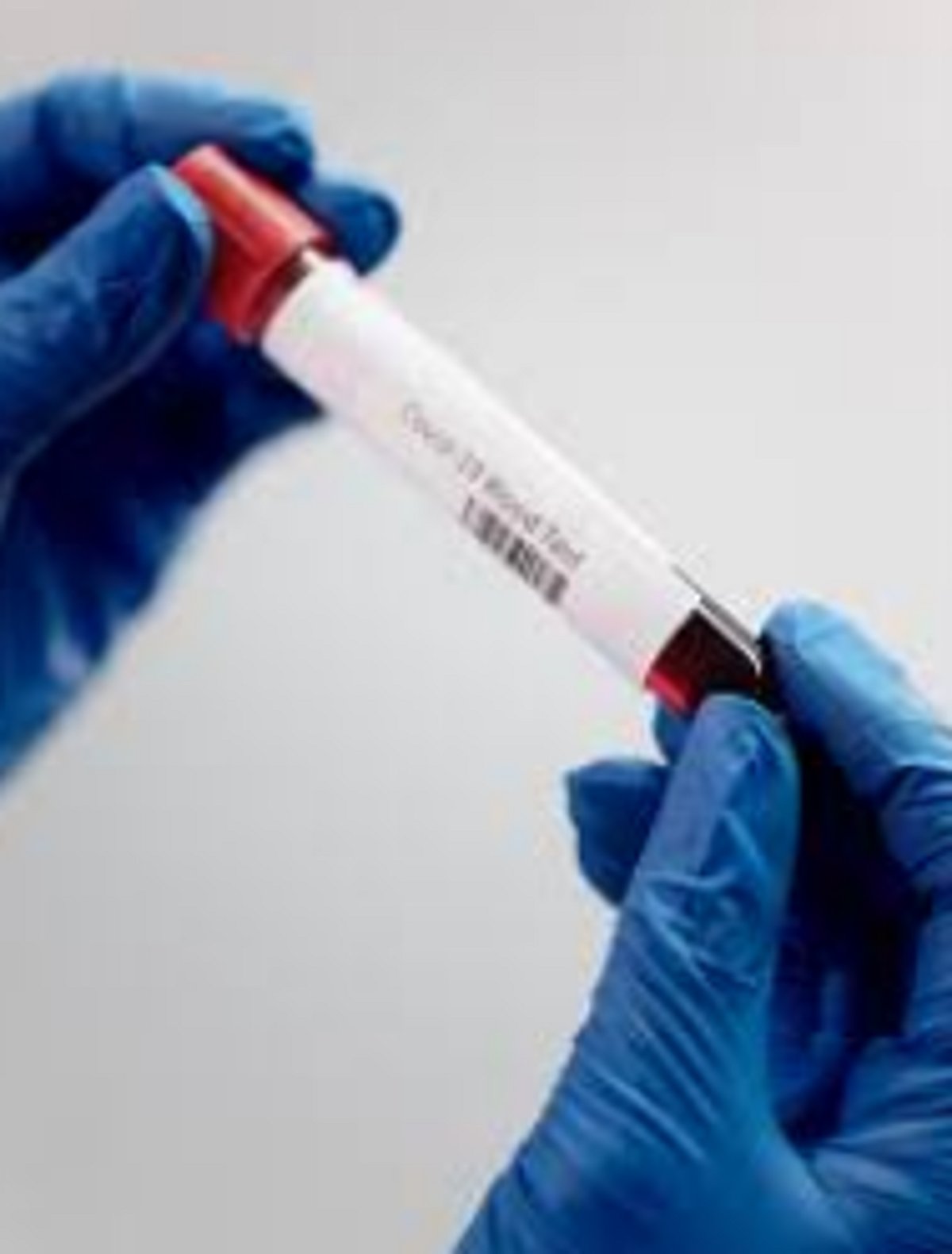 348 samples test negative for COVID-19