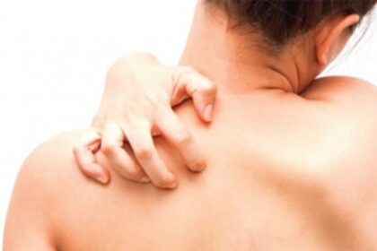 8 Things Your Itchy Skin Can Reveal About Your Health