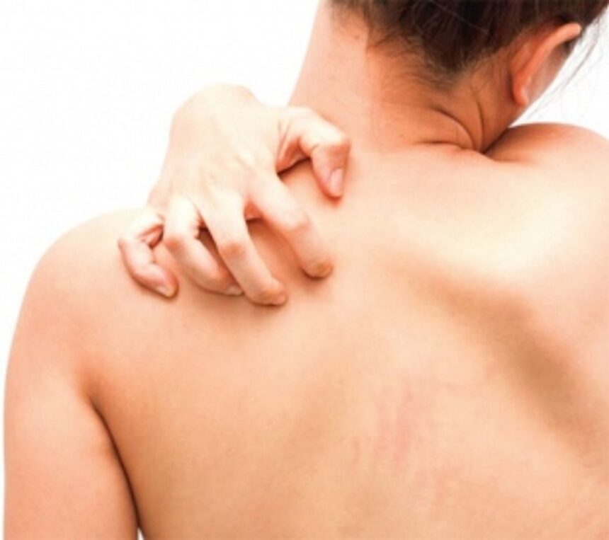 8 Things Your Itchy Skin Can Reveal About Your Health