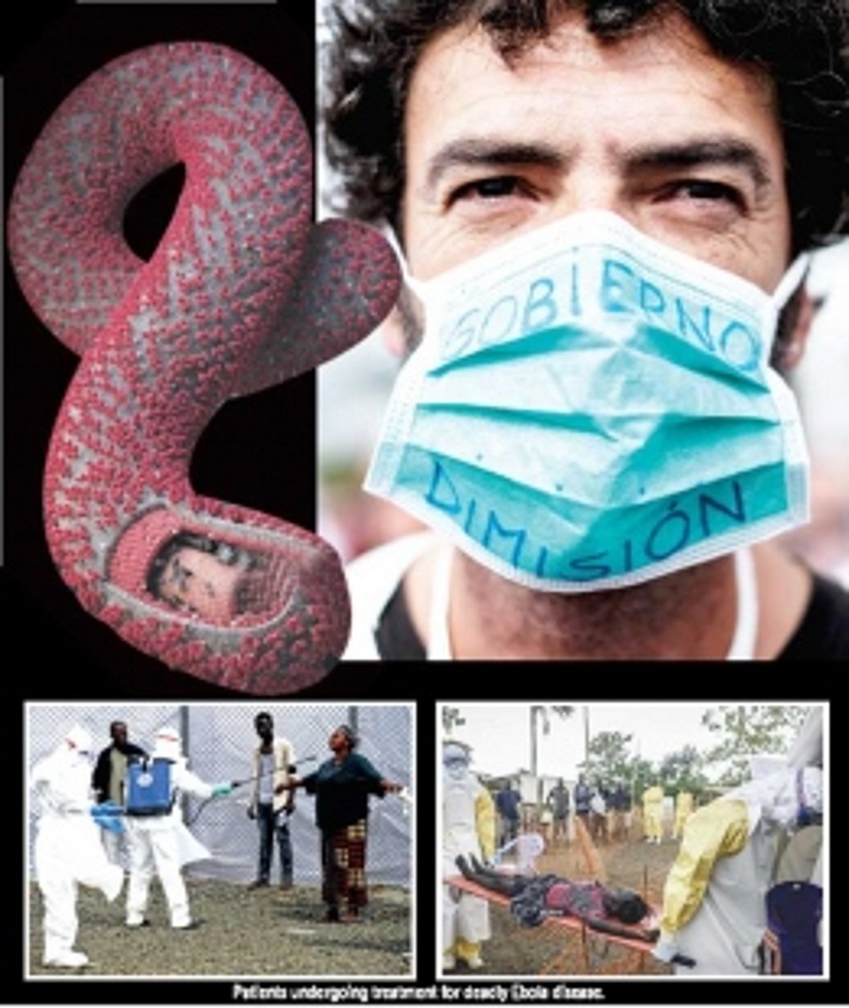 A FIVE LETTER WORD THAT KILLS...... AND WHY GOA SHOULD PROTECT ITSELF AGAINST EBOLA