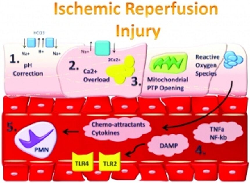 After a heart attack: Decreasing the brunt of reperfusion injury