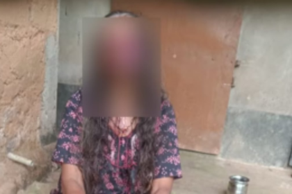 Alcohol-Fueled Assault in Karnataka: Man Bites Off Wife's Eyes and Cheeks in Disturbing Incident