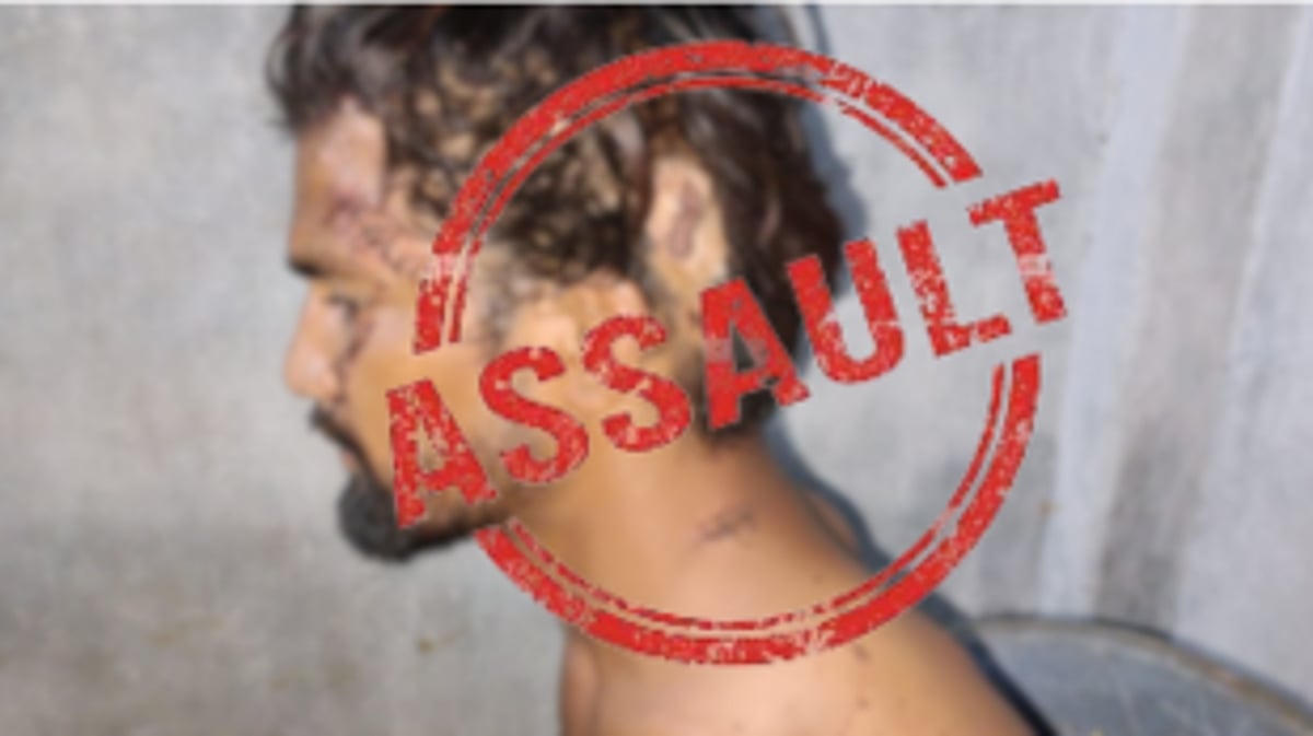 Brutal Assault at Mapusa Leaves UP Native Seriously Injured; 2 Booked