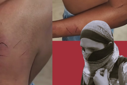 CM Orders Suspension, Possible Arrest of Teacher for Brutally Beating Student at Camurlim Primary School