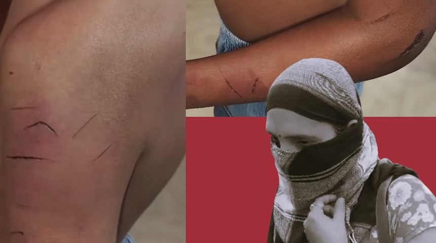 CM Orders Suspension, Possible Arrest of Teacher for Brutally Beating Student at Camurlim Primary School 1 CM Orders Suspension, Possible Arrest of Teacher for Brutally Beating Student at Camurlim Primary School