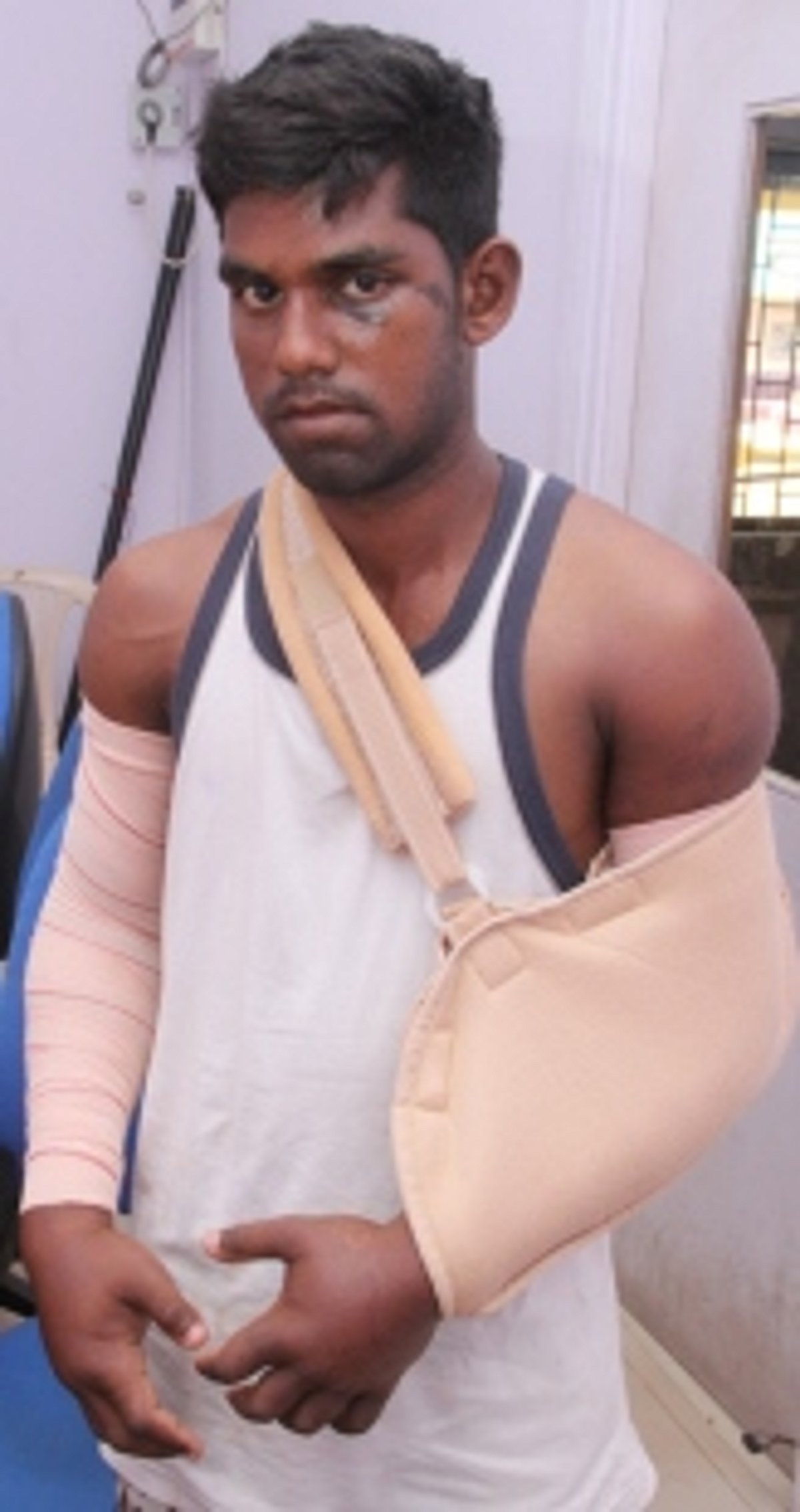 Calangute police pick up and brutally beat  19-yr-old on trumped up theft charges