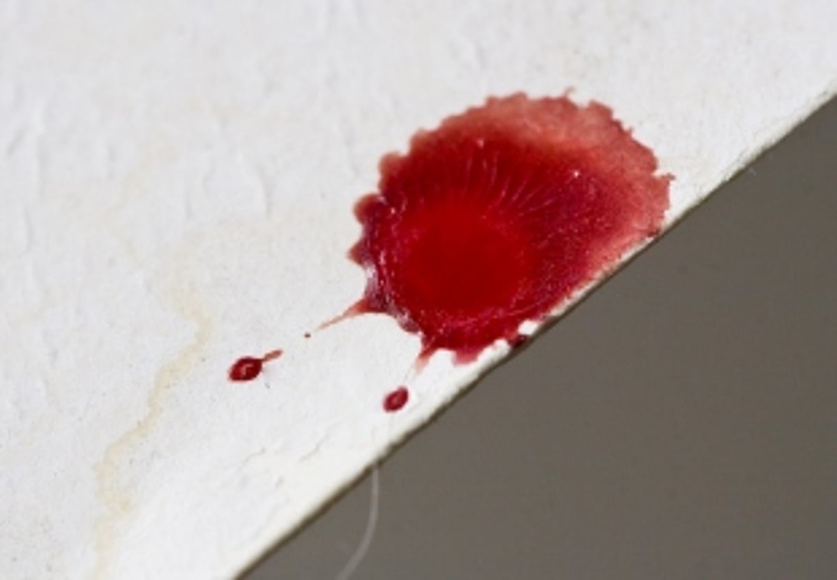 Candolim teen dies  in Bicholim mishap