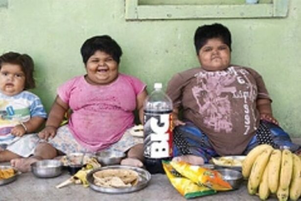 Childhood Obesity as Malnutrition