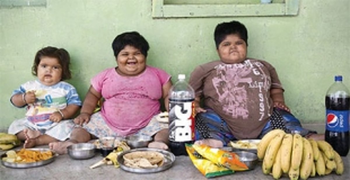 Childhood Obesity as Malnutrition