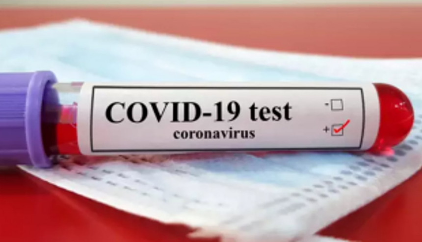 Curchorem Covid tally touches 81 1 Curchorem Covid tally touches 81