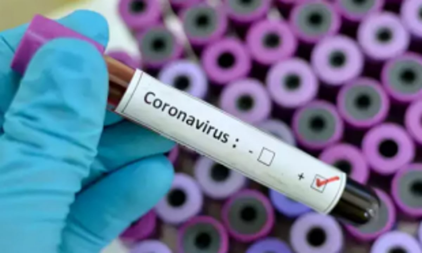 Curchorem man tests positive for COVID 1 Curchorem man tests positive for COVID