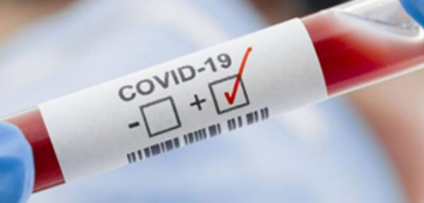 Eight more test COVID positive in Curchorem 1 Eight more test COVID positive in Curchorem