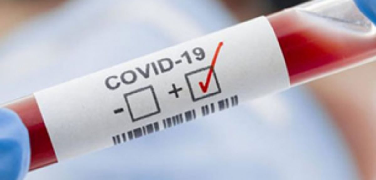 Eight more test  COVID positive  in Curchorem