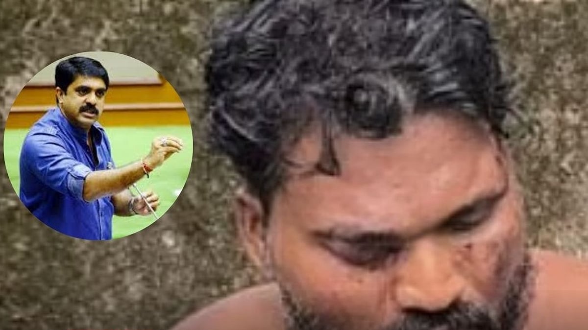 Fatorda MLA Vijai Sardesai Condemns Brutal Attack on Activist Rama Kankonkar
