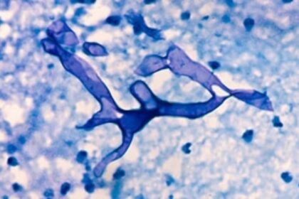 GMC ward converted for black fungus treatment