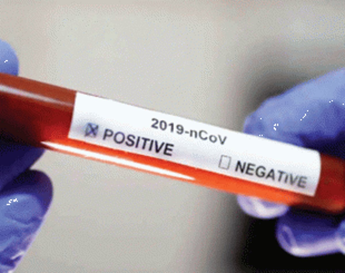 Goa positivity rate still highest in country