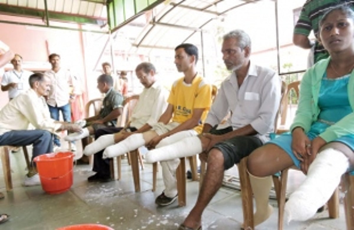 Goans flock to Margao for Jaipur foot camp
