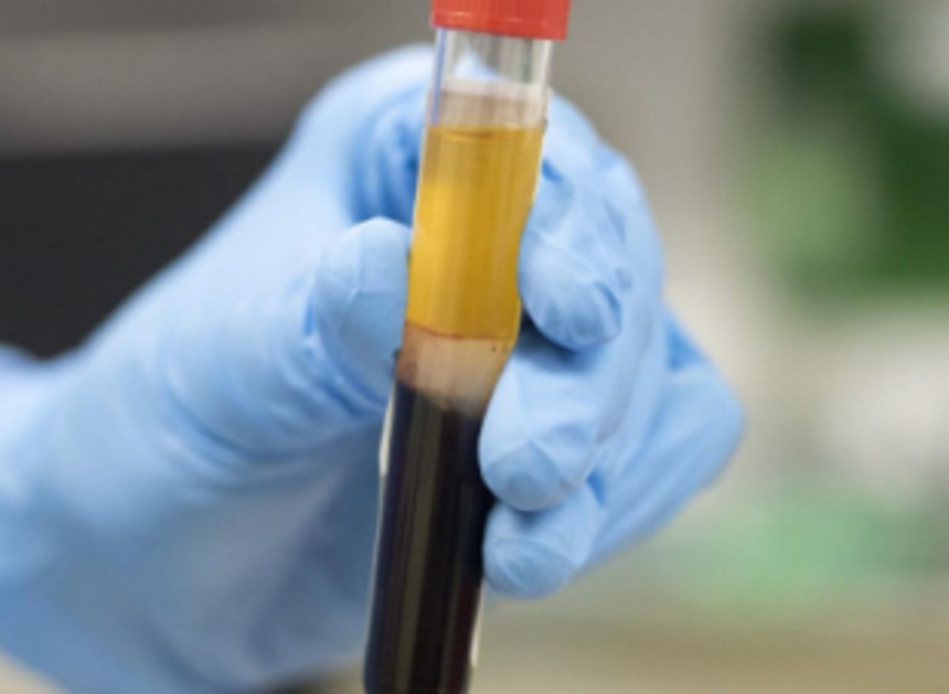 Govt to launch plasma therapy for COVID patients