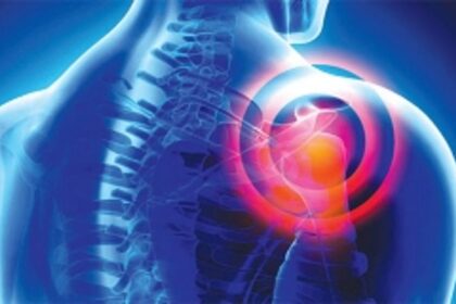 HOW TO THAW A FROZEN SHOULDER