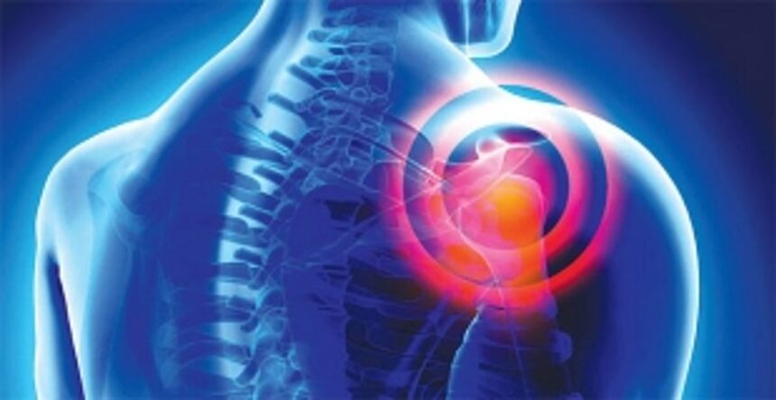 HOW TO THAW A FROZEN SHOULDER