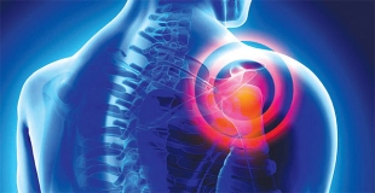 HOW TO THAW A FROZEN SHOULDER