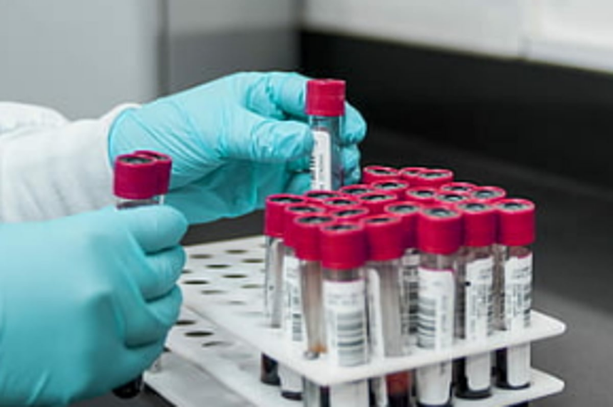 Health Dept told to prepare for large-scale testing