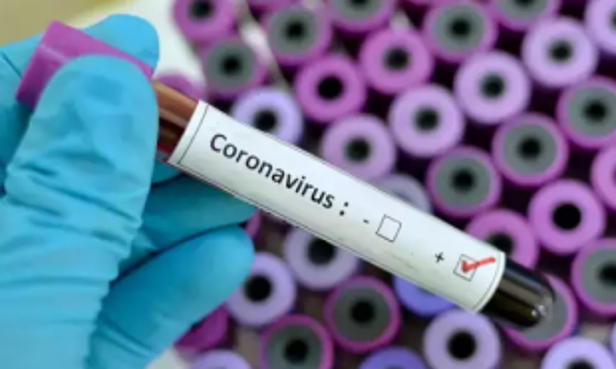 In last 15 days, State recorded  1,467 COVID cases