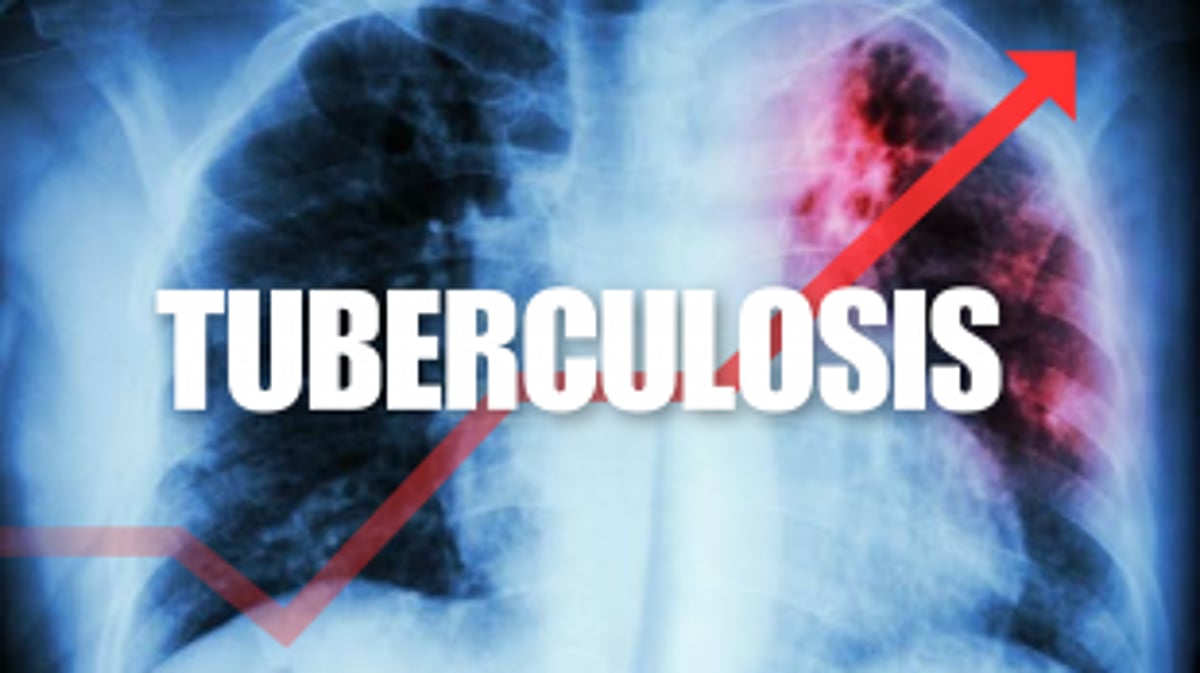 India Tops Global TB Cases in 2022, WHO Report Reveals