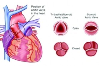 India’s first 3D printed prosthetic heart valve from Chennai