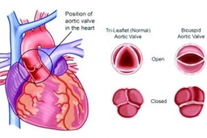 India’s first 3D printed prosthetic heart valve from Chennai