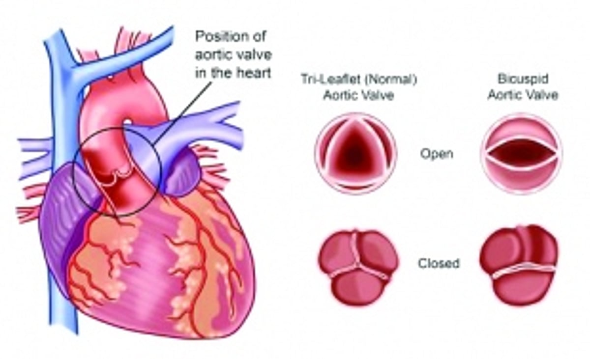 India’s first 3D printed prosthetic heart valve from Chennai