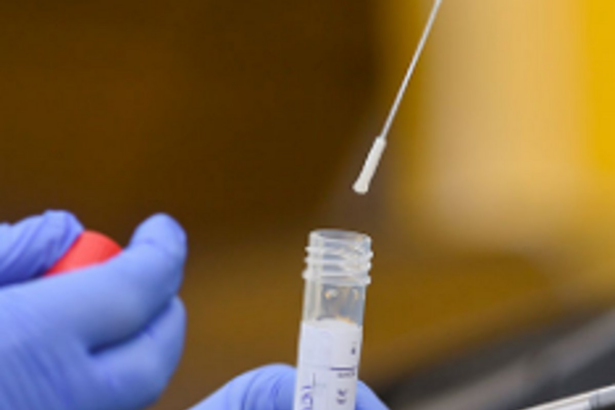 Is the decrease in number of pending tests linked to decrease in swab collection?