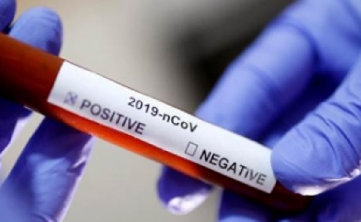 Local who returned to Aldona  from Mumbai tests positive