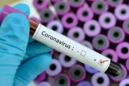 Mopa site detects 71  new COVID positive cases