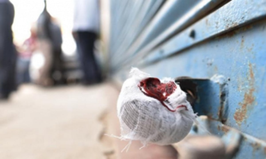 Mormurgao civic body seal shops in Vasco market for various illegalities