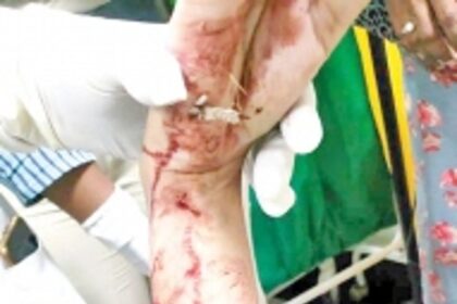 Pack of stray dogs badly maul woman in Maimollem, Vasco