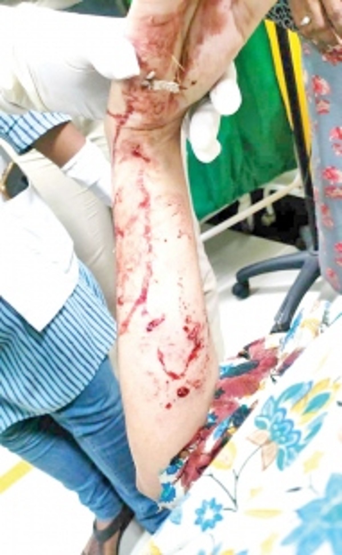 Pack of stray dogs badly maul woman in Maimollem, Vasco