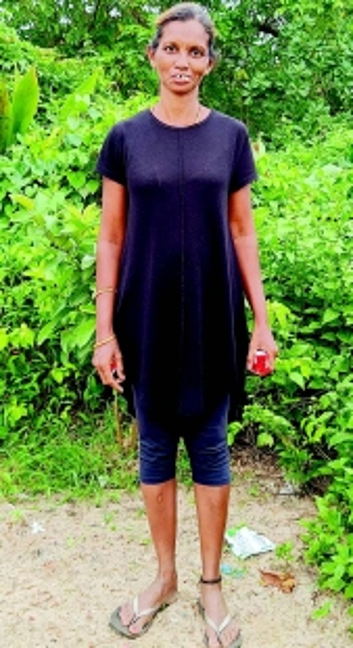 Paws and effect: Lawrence Rodrigues’ tireless efforts to feed the forgotten