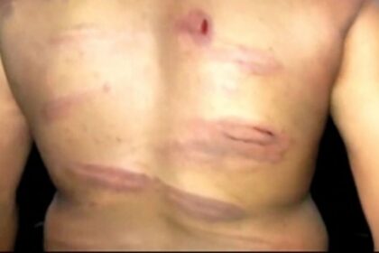 Police assault Curti youth  on picnic at Kodar river