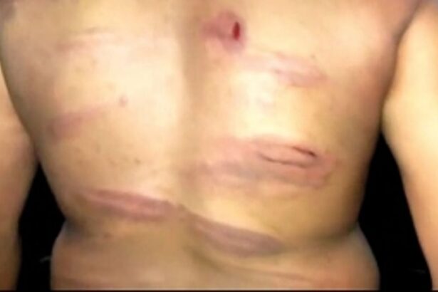 Police assault Curti youth  on picnic at Kodar river