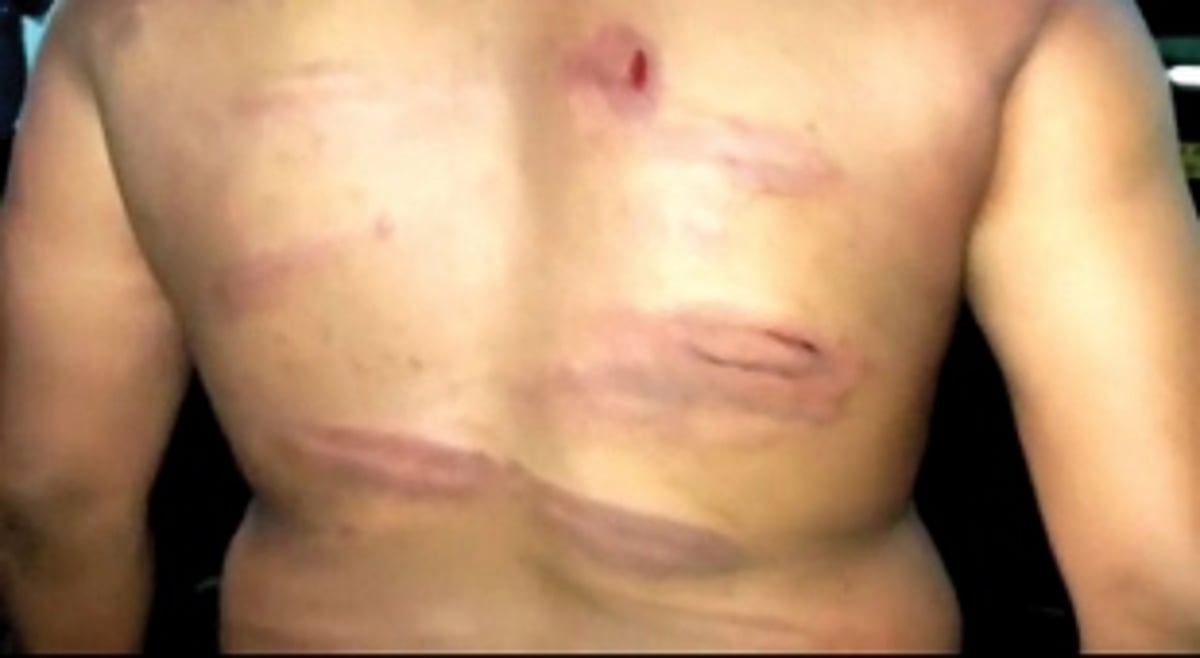 Police assault Curti youth  on picnic at Kodar river