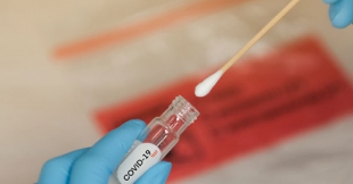 Provide fair swab testing facility for our workers at respective jetties: Purse seine boat owners