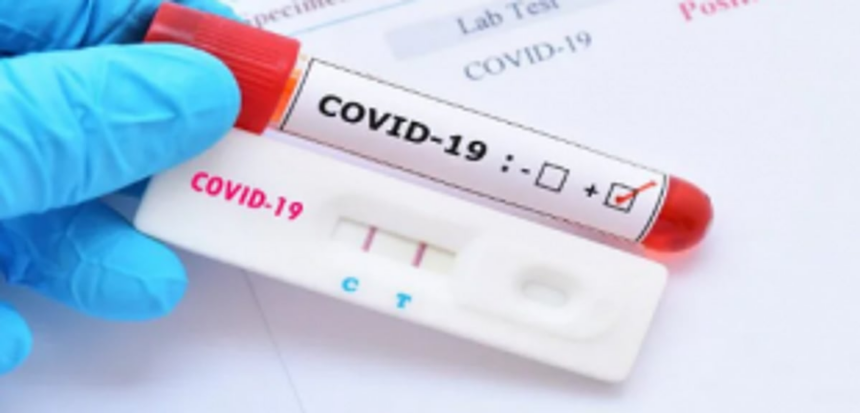 RT-PCR test mandatory for entering Maharashtra 1 RT-PCR test mandatory for entering Maharashtra
