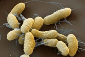 Rare Case of Bubonic Plague Linked to Pet Cat Detected in US