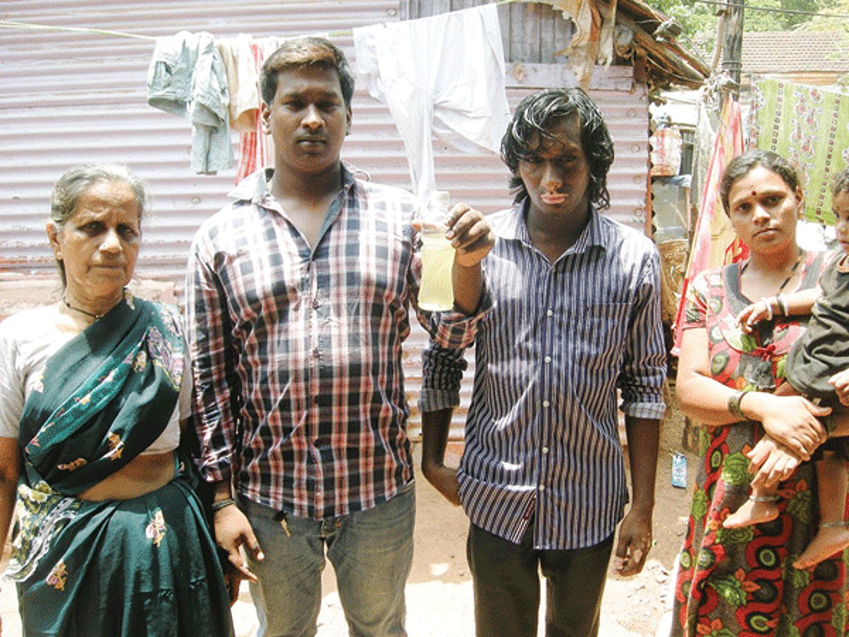 Residents inhabiting the Cine Lata display a bottle of contaminated water on Tuesday