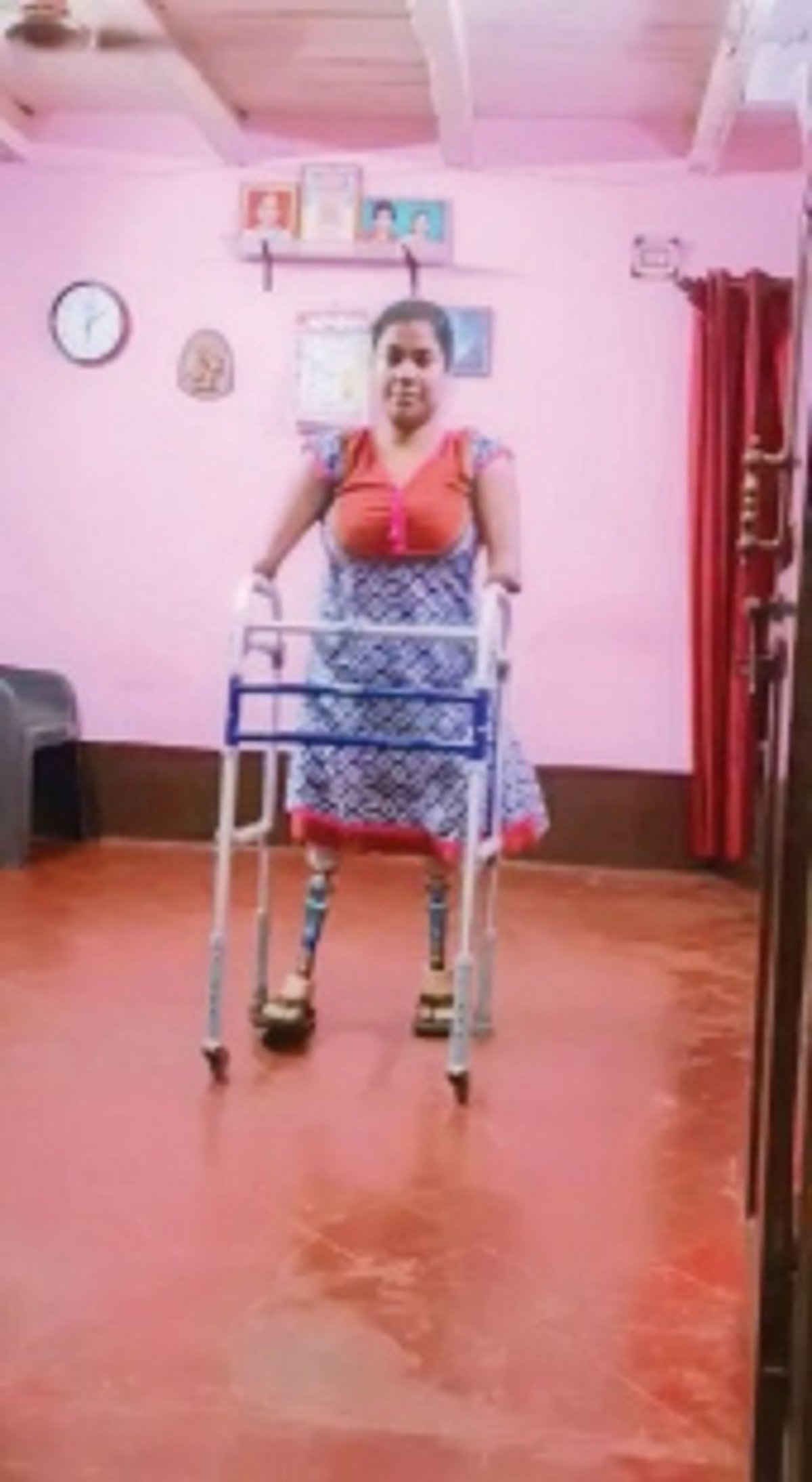 State Commission for PwDs provides prosthetic limbs to Fulrani