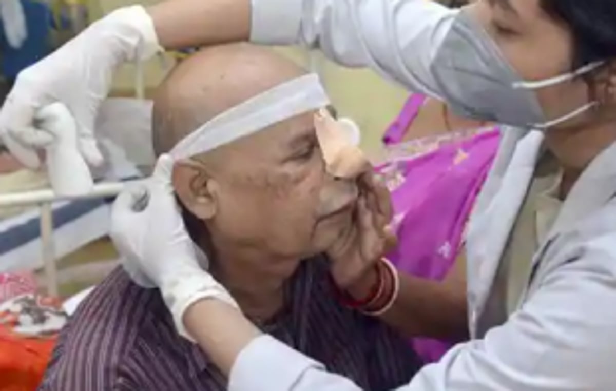 State gets more vials to treat black fungus