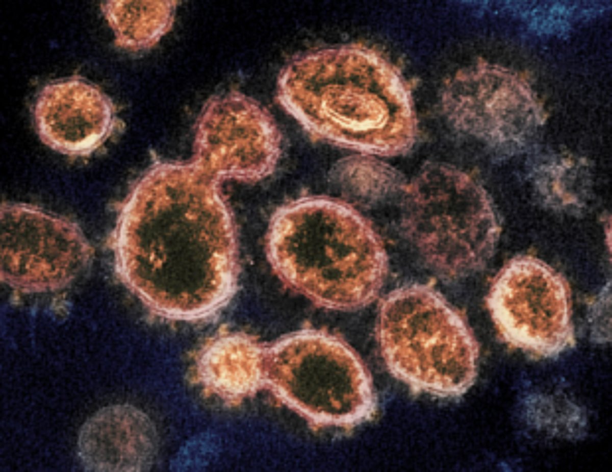 State government in a tizzy as lady on  Dubai-Goa-Bangalore flight tests positive